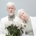 Anzahl von albinismus betroffenen Menschen auf der Welt